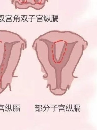 试管促排卵方案常用药物有哪些？这些药物副作用与风险要知道